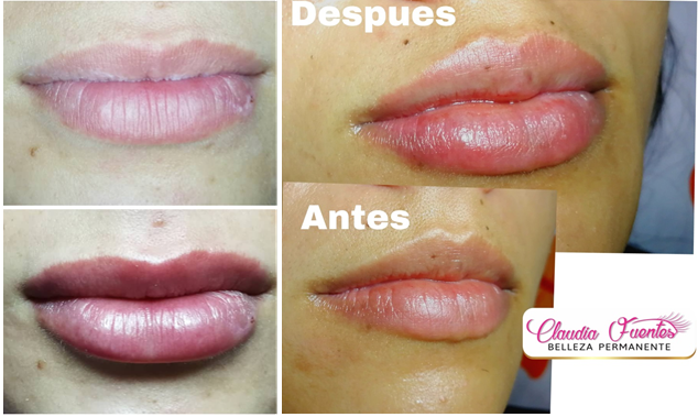 Estética facial