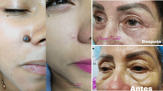 Estética facial