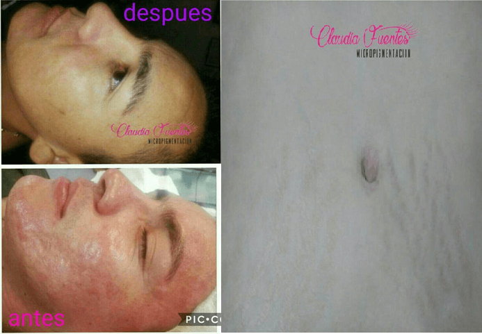 Estética facial
