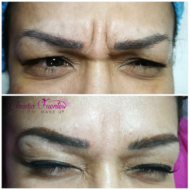 Estética facial