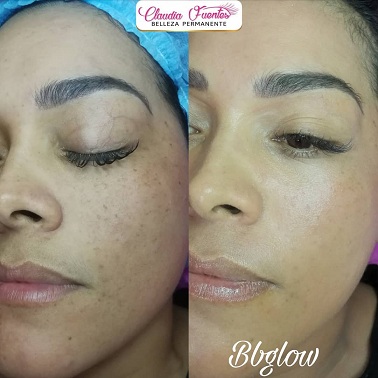 Estética facial